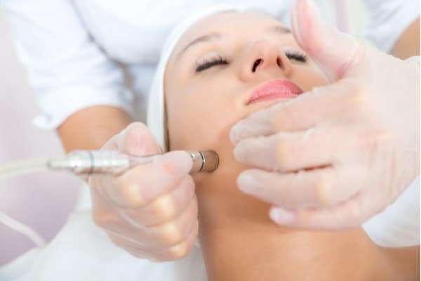 Microdermabrasion Microdermabrasion