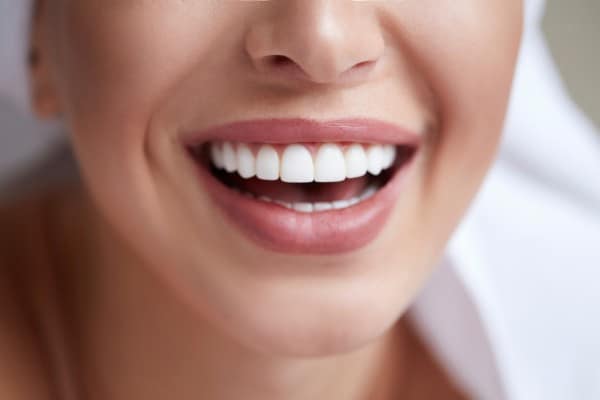 gummy smile treatments
